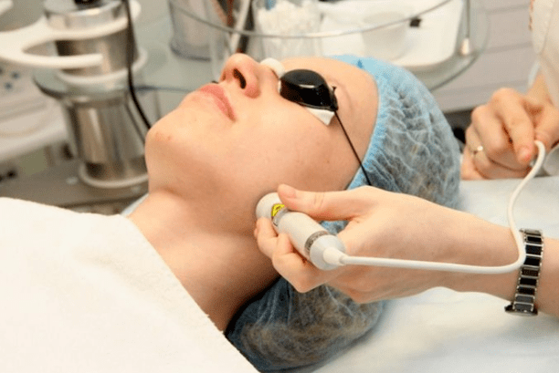 Bioristizzazione laser
